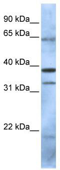 WB Suggested Anti-PCGF5 Antibody Titration: 0.2-1 ug/ml; ELISA Titer: 1:1562500; Positive Control: 293T cell lysate