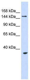 WB Suggested Anti-UBE3B Antibody Titration: 0.2-1 ug/ml; ELISA Titer: 1:312500; Positive Control: 293T cell lysate