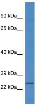 WB Suggested Anti-Rnf183 Antibody; Titration: 1.0 ug/ml; Positive Control: Mouse Thymus