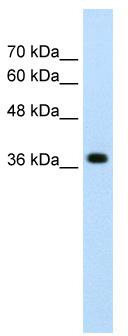 WB Suggested Anti-LONRF1 Antibody Titration: 2.5ug/ml; Positive Control: HepG2 cell lysate