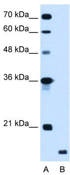 WB Suggested Anti-RNF175 Antibody Titration: 1.25 ug/ml; Positive Control: HepG2 cell lysate