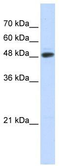 WB Suggested Anti-C14orf130 Antibody Titration: 0.2-1 ug/ml; ELISA Titer: 1: 62500; Positive Control: Transfected 293T