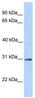 WB Suggested Anti-RNF148 Antibody Titration: 0.2-1 ug/ml; Positive Control: Human brain