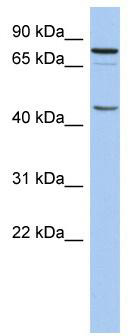 WB Suggested Anti-RNF169 Antibody Titration: 0.2-1 ug/ml; ELISA Titer: 1: 312500; Positive Control: THP-1 cell lysate
