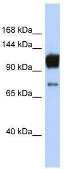 Host: Rabbit; Target Name: ABCA2; Sample Tissue: Jurkat Whole Cell lysates; Antibody Dilution: 1.0ug/ml