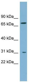 WB Suggested Anti-ABCD3 Antibody Titration: 0.2-1 ug/ml; ELISA Titer: 1: 1562500; Positive Control: Human Small Intestine