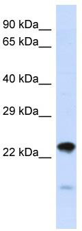 Host: Rabbit; Target Name: NIPSNAP3A; Sample Tissue: HepG2 Whole Cell lysates; Antibody Dilution: 1.0ug/ml