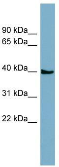 WB Suggested Anti-SLC35D3 Antibody Titration: 0.2-1 ug/ml; ELISA Titer: 1:62500; Positive Control: ACHN cell lysate