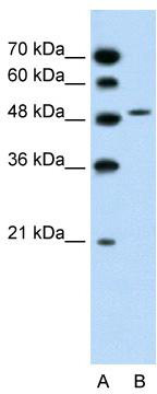 WB Suggested Anti-SLC10A5 Antibody Titration: 1.25 ug/ml; Positive Control: Jurkat cell lysate