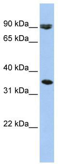 Gel: 8%SDS-PAGE<br>Lysate: 40 μg<br>Lane: Hela cells<br>Primary antibody: TA364720 (SEPTIN7 Antibody) at dilution 1/380<br>Secondary antibody: Goat anti rabbit IgG at 1/8000 dilution<br>Exposure time: 30 seconds
