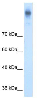 WB Suggested Anti-SLC12A2 Antibody Titration: 5.0 ug/ml; ELISA Titer: 1:1562500; Positive Control: DLD1 cell lysateSLC12A2 is supported by BioGPS gene expression data to be expressed in DLD1