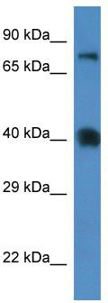 WB Suggested Anti-Slc7a3 Antibody; Titration: 1.0 ug/ml; Positive Control: Mouse Spleen