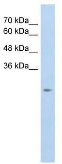 WB Suggested Anti-SLC25A45 Antibody Titration: 5.0 ug/ml; Positive Control: HepG2 cell lysate