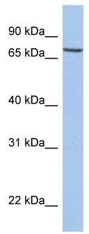 WB Suggested Anti-SLC20A1 Antibody Titration: 0.2-1 ug/ml; Positive Control: MCF7 cell lysate