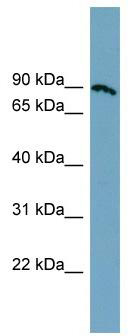 WB Suggested Anti-SLC6A14 Antibody Titration: 0.2-1 ug/ml; Positive Control: COLO205 cell lysate