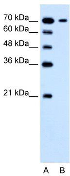 WB Suggested Anti-SLC5A4 Antibody Titration: 1.25 ug/ml; Positive Control: Jurkat cell lysate