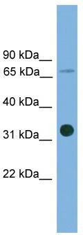 WB Suggested Anti-SLC5A4 Antibody Titration: 0.2-1 ug/ml; ELISA Titer: 1:1562500; Positive Control: THP-1 cell lysate