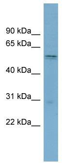 WB Suggested Anti-SLC7A11 Antibody Titration: 0.2-1 ug/ml; ELISA Titer: 1:312500; Positive Control: THP-1 cell lysate