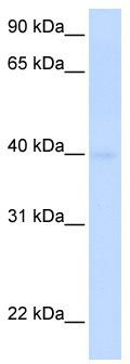 Typical titration curve of Thymosin β-4 in a competitive ELISA with this antibody