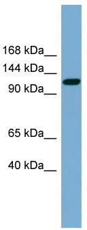 WB Suggested Anti-SLC12A5 Antibody Titration: 0.2-1 ug/ml; Positive Control: Human Spleen