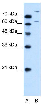 WB Suggested Anti-SLC26A1 Antibody Titration: 0.2-1 ug/ml; Positive Control: HepG2 cell lysate