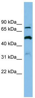 WB Suggested Anti-SLC26A1 Antibody Titration: 0.2-1 ug/ml; ELISA Titer: 1:312500; Positive Control: OVCAR-3 cell lysate;SLC26A1 is strongly supported by BioGPS gene expression data to be expressed in Human OVCAR3 cells