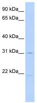 Typical titration curve of Endothelin-1 in a competitive ELISA with this antibody