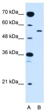 WB Suggested Anti-SLC2A10 Antibody Titration: 2.5 ug/ml; Positive Control: Jurkat cell lysate