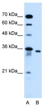 Typical titration curve of (Arg8)-Vasopressin in a competitive ELISA with this antibody