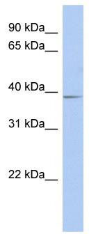 WB Suggested Anti-SLC25A28 Antibody Titration: 0.2-1 ug/ml; ELISA Titer: 1:1562500; Positive Control: Human Stomach