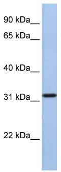 WB Suggested Anti-SLC25A28 Antibody Titration: 1 ug/ml; Positive Control: MCF-7 whole cell lysates