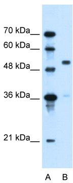 Typical titration curve of ANF (1-28) in a competitive ELISA with this antibody