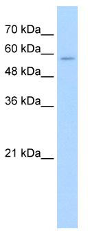 WB Suggested Anti-SLC22A16 Antibody Titration: 2.5 ug/ml; Positive Control: HepG2 cell lysate