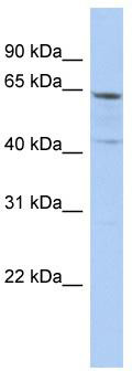 WB Suggested Anti-SLC32A1 Antibody Titration: 0.2-1 ug/ml; ELISA Titer: 1:312500; Positive Control: PANC1 cell lysate