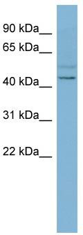WB Suggested Anti-SLC46A1 Antibody Titration: 0.2-1 ug/ml; ELISA Titer: 1: 2500; Positive Control: OVCAR-3 cell lysate