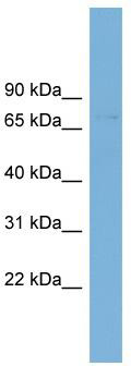 WB Suggested Anti-SLC2A12 Antibody Titration: 0.2-1 ug/ml; Positive Control: PANC1 cell lysate