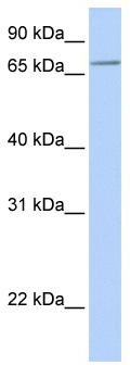 WB Suggested Anti-SLC44A3 Antibody Titration: 0.2-1 ug/ml; ELISA Titer: 1:1562500; Positive Control: Hela cell lysate