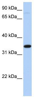 WB Suggested Anti-SLC44A3 Antibody Titration: 0.2-1 ug/ml; ELISA Titer: 1:312500; Positive Control: Hela cell lysate