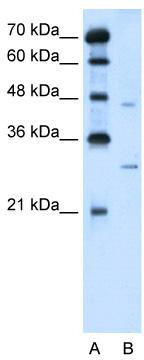 WB Suggested Anti-SLC36A3 Antibody Titration: 5.0 ug/ml; Positive Control: Jurkat cell lysate