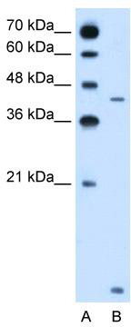WB Suggested Anti-SLC46A3 Antibody Titration: 2.5 ug/ml; Positive Control: Jurkat cell lysate;SLC46A3 is supported by BioGPS gene expression data to be expressed in Jurkat