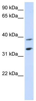 WB Suggested Anti-SLC25A34 Antibody Titration: 0.2-1 ug/ml; ELISA Titer: 1: 312500; Positive Control: Human Placenta