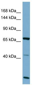 Host: Rabbit; Target Name: OCA2; Sample Tissue: OVCAR-3 Whole cell lysates; Antibody Dilution: 1.0 ug/ml