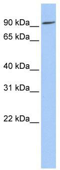WB Suggested Anti-OCA2 Antibody Titration: 0.2-1 ug/ml; ELISA Titer: 1: 312500; Positive Control: Human Placenta