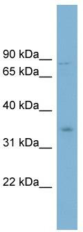 WB Suggested Anti-GPD2 Antibody Titration: 0.2-1 ug/ml; Positive Control: ACHN cell lysate