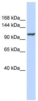 WB Suggested Anti-ATP2B4 Antibody Titration: 0.2-1 ug/ml; ELISA Titer: 1: 1562500; Positive Control: 721_B cell lysate.There is BioGPS gene expression data showing that ATP2B4 is expressed in 721_B