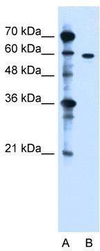 WB Suggested Anti-ZDHHC13 Antibody Titration: 1.25 ug/ml; Positive Control: Jurkat cell lysate