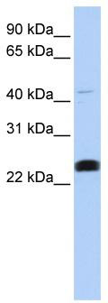 WB Suggested Anti-LYCAT Antibody Titration: 0.2-1 ug/ml; ELISA Titer: 1: 1562500; Positive Control: 721_B cell lysate