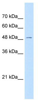 WB Suggested Anti-GPR177 Antibody Titration: 0.5 ug/ml; Positive Control: Jurkat cell lysate