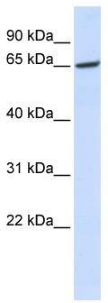 WB Suggested Anti-GPR177 Antibody Titration: 0.2-1 ug/ml; ELISA Titer: 1: 62500; Positive Control: Human Liver