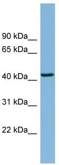 WB Suggested Anti-DNAJB12 Antibody Titration: 0.2-1 ug/ml; ELISA Titer: 1: 1562500; Positive Control: Human Spleen
